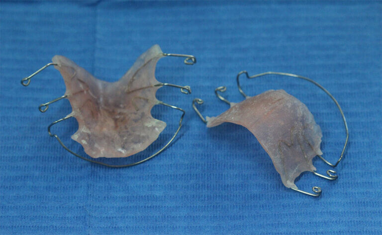 kinites-orthodontikes-siskeues